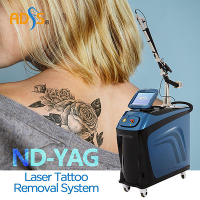 Geschakelde de Lasermachine van Nd Yag Q voor Huidverjonging 1064nm