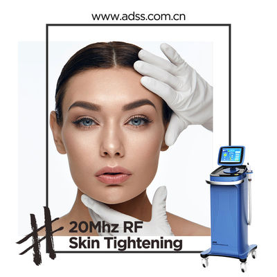 Recentste Thermage-Machine, het Materiaalprijs van rf Thermage voor Huidverjonging
